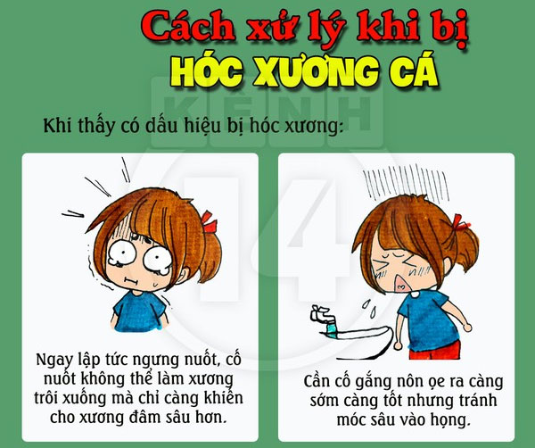 Cách xử lý 'chuẩn không cần chỉnh' khi bị hóc xương cá