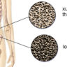 4 nhóm thực phẩm âm thầm làm thất thoát canxi và cách ứng xử hợp lý