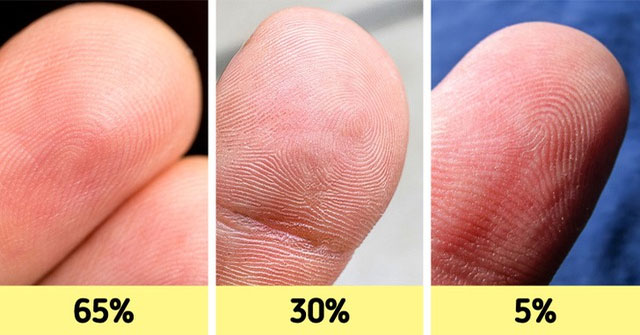 12 đặc điểm cơ thể hiếm gặp và cách nhận biết chúng